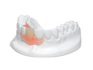 Flexible Dentures – Comfortable & Durable Teeth Replacement